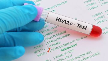 مستويات السكر التراكمي تنذر بإصابتك بالسكري.. فيديو مستويات السكر التراكمي تنذر بإصابتك بالسكري.. فيديو