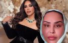 أحلام تظهر بالحجاب بعد خضوعها لشد الوجه ..صورة - sa