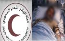 اتصال هاتفي بالهلال الأحمر ينقذ يمنيا من صعق كهربائي كاد يودي بحياته .. فيديو
