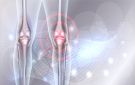 أعراض تستدعي مراجعة طبيب الروماتيزم