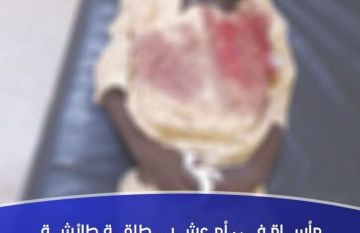 مأساة في أم عشر.. طلقة طائشة تنهي حياة طفل أثناء نومه داخل منزله مأساة في أم عشر.. طلقة طائشة تنهي حياة طفل أثناء نومه داخل منزله
