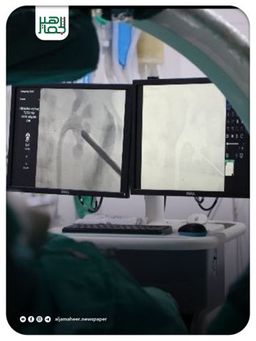 إنجاز طبي بتقنية PCNL في مشفى الشفاء بإدلب يخفف معاناة مريض ويعيد له الصحة
