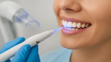 وزارتا الصحة والتجارة تحذران من تبييض الأسنان خارج العيادات الطبية