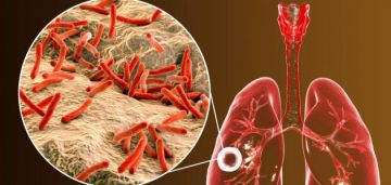 ملتقى علمي بأريانة تحت شعار: مالجديد في مرض السل لسنة 2026؟