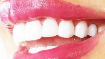 وزارتا الصــــحة والتجــــارة تحــذران من تبييض الأسنان خارج العيادات الطبية