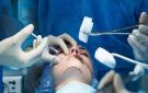 نقابة أطباء التجميل تحذر من الانتشار الكبير للمراكز العشوائية في تونس - tn
