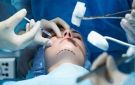 فراغ تشريعي يثير المخاوف من تجاوزات في مجال الجراحات التجميلية - tn