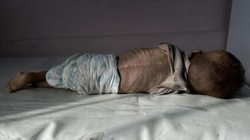 الصحة بغزة :تسجيل حالتي وفاة لطفلين نتيجة المجاعة خلال الـ24 ساعة الماضية الصحة بغزة :تسجيل حالتي وفاة لطفلين نتيجة المجاعة خلال الـ24 ساعة الماضية