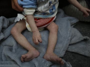 الصحة بغزة: تسجيل حالة وفاة نتيجة المجاعة خلال الـ24 ساعة الماضية