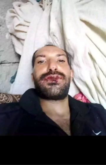 سجن تابع للتحالف في الضالع يتحول إلى معتقل داعشي وتعذيب مواطن حتى كسر فمه سجن تابع للتحالف في الضالع يتحول إلى معتقل داعشي وتعذيب مواطن حتى كسر فمه