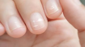 الكالسيوم.. المعدن الحيوي لصحة العظام والبشرةعلامات نقصه تبدأ من الأظافر الكالسيوم.. المعدن الحيوي لصحة العظام والبشرةعلامات نقصه تبدأ من الأظافر