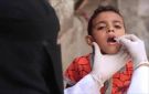 تسجيل 29 حالة إصابة بفيروس شلل الأطفال في اليمن - ye