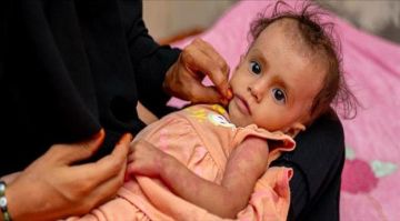 أطفال اليمن... سوء التغذية يعوق نمو الصغار وسط النزاع أطفال اليمن... سوء التغذية يعوق نمو الصغار وسط النزاع