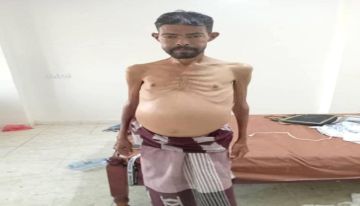 مناشدة إنسانية لا تحتمل التأجيل مناشدة إنسانية لا تحتمل التأجيل