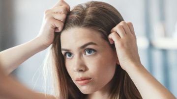 قشرة الرأس الدهنية مشكلة تؤرق الفتيات شتاء.. إليك طرق علاجها قشرة الرأس الدهنية مشكلة تؤرق الفتيات شتاء.. إليك طرق علاجها