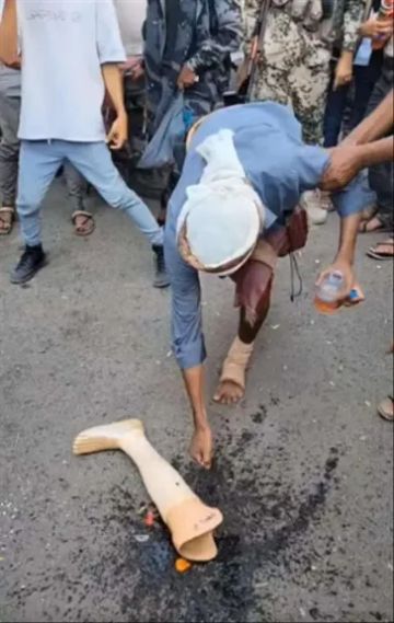 بمشهد يدمي القلوب.. جريح حرب في تعز يحرق طرفه الصناعي احتجاجا على تجاهل مستحقاته