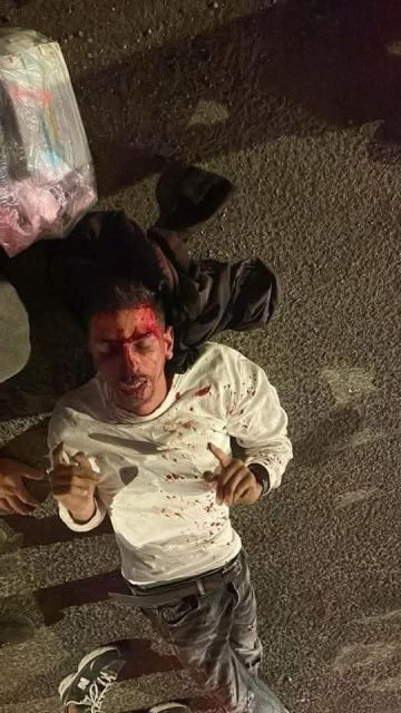 قوات الاحتلال تعتدي على فلسطينيين بالقدس وبيت لحم قوات الاحتلال تعتدي على فلسطينيين بالقدس وبيت لحم