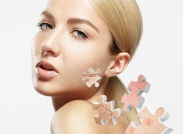 أكثر أسباب جفاف البشرة في الشتاء وكيف تتجنبينها؟