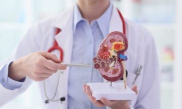 دراسة: أمراض الكلى المزمنة تاسع أبرز سبب للوفاة على مستوى العالم