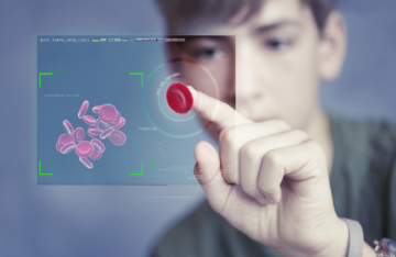 نموذج ذكاء اصطناعي لتحديد مسببات الأمراض النادرة