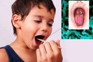 تفشي وباء الدفتيريا في شبوة وإغلاق المدارس بعد حالات وفاة تفشي وباء الدفتيريا في شبوة وإغلاق المدارس بعد حالات وفاة