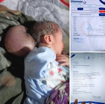 يتطلب تدخل جراحي عاجل .. مناشدة عاجلة لإنقاذ حياة طفل مولود يتطلب تدخل جراحي عاجل .. مناشدة عاجلة لإنقاذ حياة طفل مولود