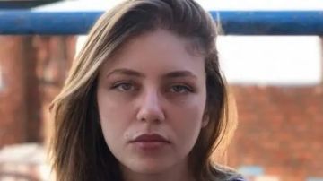 تسببت في عاهة مستدامة.. رحمة حسن تكشف تفاصيل خطأ طبي أفقدها شعرها