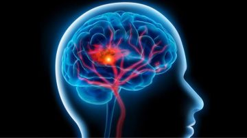 إنتبه.. 7 علامات تحذيرية تشير لإحتمالية إصابتك بالسكتة الدماغية إنتبه.. 7 علامات تحذيرية تشير لإحتمالية إصابتك بالسكتة الدماغية