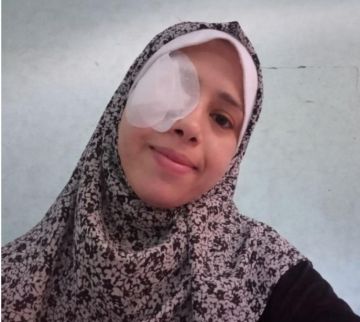 المجاعة وقصف العدو الإسرائيلي يفقدان شابة غزية عينها ويهددان بصرها بالكامل