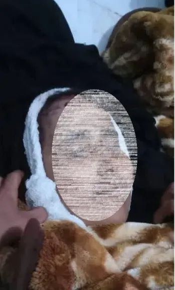 جريمة تهز اليمن.. مسلحون يهشمون جمجمة امرأة لنهب حوالة كانت بحوزتها