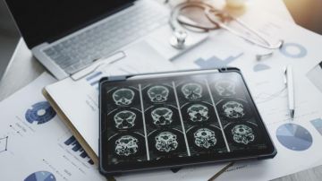 باحثون يطلقون أداة ذكاء إصطناعي تتنبأ بالأمراض اثناء النوم