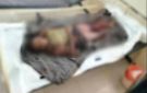 مقتل طفل بانفجار لغم حوثي في الحديدة