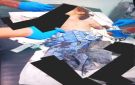 الضالع: إصابة طفلة بانفجار بقايا مقذوف متفجر أثناء توجهها إلى المدرسة