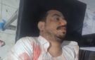 مالك محطات للمحروقات في حضرموت يلقى حتفه في كمين مسلح في أبين