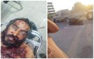 مصرع قيادي بتنظيم القاعدة الإرهابي خلال اشتباكات في أبين