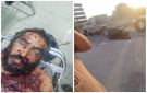 مصرع قيادي بتنظيم القاعدة الإرهابي خلال اشتباكات في أبين - ye