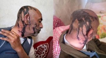 اعتداء عنصرين من مليشيا الحوثي على والدهما المسن في محافظة عمران اليمنية