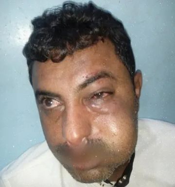 قيادي حوثي يعتدي بوحشية على محام في الشارع العام