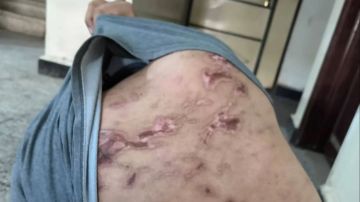 صحيفة سعودية تهاجم الإمارات وتكشف تفاصيل تعذيب مروعة داخل سجن سري في مطار الريان صحيفة سعودية تهاجم الإمارات وتكشف تفاصيل تعذيب مروعة داخل سجن سري في مطار الريان