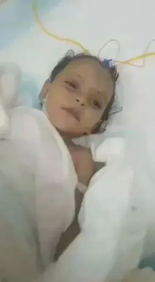 خروج الطفلة أسماء من العناية المركزة بإحدى مستشفيات السعودية عقب إصابتها في هجوم حوثي على مأدبة إفطار بحجة (فيديو)