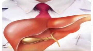 تعرف على طرق بسيطة لتعويض نقص الفيتامينات أثناء الصيام تعرف على طرق بسيطة لتعويض نقص الفيتامينات أثناء الصيام