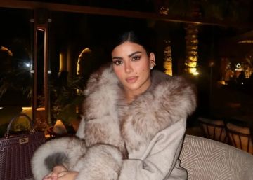 كارولين عزمي تعلق على إصابتها في برنامج رامز ليفل الوحش