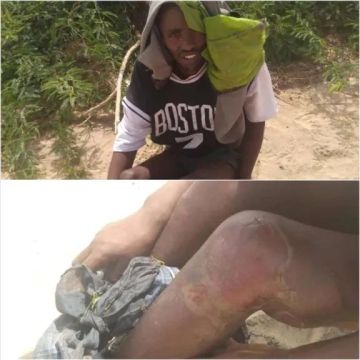 في أحور بأبين: وحشية مطلقة وابتزاز مالي منظم يحول حياة المهاجرين الأفارقة المسلمين إلى كابوس في أحور بأبين: وحشية مطلقة وابتزاز مالي منظم يحول حياة المهاجرين الأفارقة المسلمين إلى كابوس