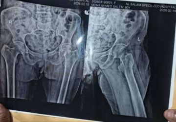 سعر كرسي متحرك حول حياة جدة إلى جحيم! 105 ألف ريال بينها وبين الحياة.. هل ستتخلى عنها؟