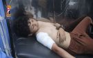تعز.. إصابة أربعة أطفال بشظايا قذيفة من مرتزقة العدوان في وادي صالة