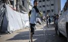  مركز الأطراف بغزة: 6 آلاف حالة بتر منذ بدء حرب الإبادة