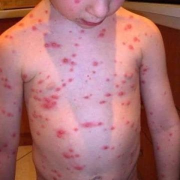 أبو سليمة: مليون ونصف نازح في غزة يواجهون ظروفا إنسانية وصحية قاسية أبو سليمة: مليون ونصف نازح في غزة يواجهون ظروفا إنسانية وصحية قاسية