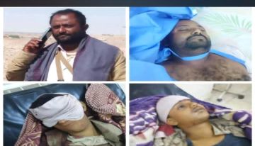قائد قوات الأمن الوطني بالصبيحة يعزي قيادة اللواء الرابع درع الوطن واسر شهداء الهجوم القادر في مرآة قائد قوات الأمن الوطني بالصبيحة يعزي قيادة اللواء الرابع درع الوطن واسر شهداء الهجوم القادر في مرآة