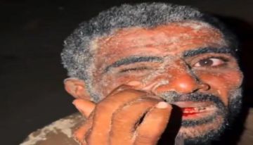 المكلا : العنف يسود مهرجان البلدة المكلا : العنف يسود مهرجان البلدة