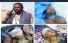 قائد قوات الأمن الوطني بالصبيحة يعزي قيادة اللواء الرابع درع الوطن واسر شهداء الهجوم القادر في مرآة - ye